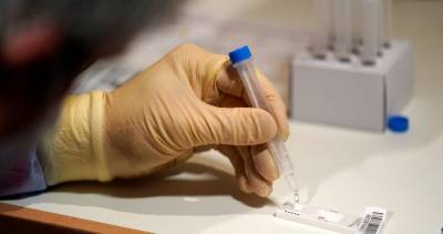 Coronavirus: Saskatchewan adds 1 new death, 87 new COVID-19 infections - globalnews.ca
