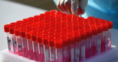 55 new coronavirus cases, 257 additional variant cases confirmed in Simcoe Muskoka - globalnews.ca - Canada - county Simcoe - county Bradford