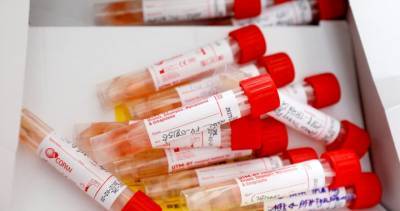 32 new coronavirus cases, 1 additional death confirmed in Simcoe Muskoka - globalnews.ca - Canada - county Simcoe