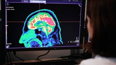 More than a third of COVID-19 survivors suffer neurological and psychiatric effects, study finds - fox29.com - Los Angeles