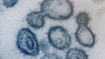 NIH study finds coronavirus infects mouth cells, saliva - fox29.com