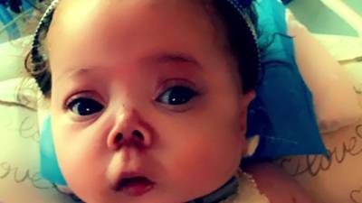Defying the odds: Chester County girl born without rib cage may soon be able to go home - fox29.com - state Pennsylvania - county Chester - county Oxford - Philadelphia, county Chester