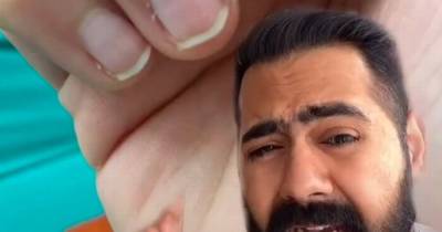 Karan Raj - Doctor says change in your fingernails could hint if you've already had Covid-19 - dailyrecord.co.uk
