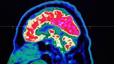 Short breaks may help brain learn new skills, NIH study says - fox29.com - Los Angeles