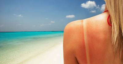 Health expert debunks viral TikTok sunburn hacks – from sour cream to mouthwash - dailystar.co.uk - Britain