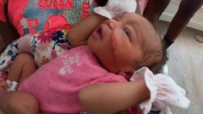 Newborn baby's face gets cut during emergency C-section - fox29.com - state Florida