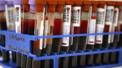 US blood banks hit ‘unprecedented’ critical shortage - fox29.com - Usa - state Illinois