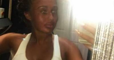 Young mum 'addicted' to tanning says she 'didn't really care' about health risks - dailyrecord.co.uk
