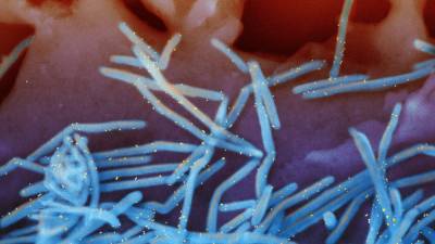 Cold weather virus in summer baffles doctors, worries parents - fox29.com - New York