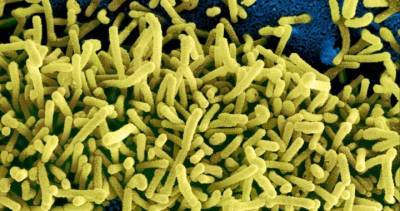 Matshidiso Moeti - Guinea reports first-ever case of rare and deadly Marburg virus - globalnews.ca - Guinea