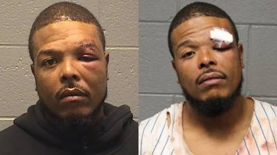 Man attacks off-duty Chicago police officer, bites off friend’s nipple in road rage incident: report - fox29.com - city Chicago - city Sunday