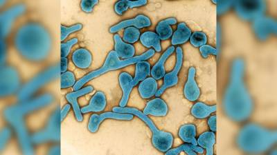 Marburg virus: Guinea reports first-ever case of deadly disease, WHO says - fox29.com - Guinea - Liberia - Sierra Leone