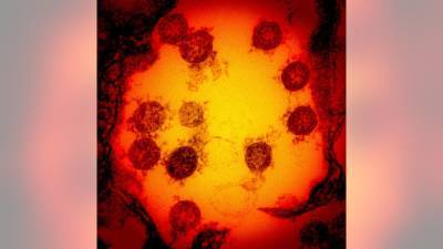 Cholesterol drug cuts coronavirus infection by 70%, researchers find - fox29.com - Usa - Italy - county Frontier