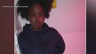 Woman allegedly beaten by Philadelphia police reaches multimillion-dollar settlement with city - fox29.com