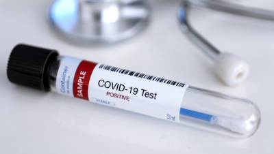 Robin Swann - 1,413 new cases of Covid-19 with 290 people in hospital - rte.ie - Ireland