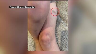 Parents searching for answers after son got unexplained bruises at New Jersey daycare - fox29.com - state New Jersey - county Hill - county Cherry