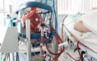 Study: 90% of young ECMO-eligible COVID patients at a US hospital died amid rationing - cidrap.umn.edu - Usa