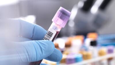Paddy Mallon - Antibodies could determine fourth vaccine eligibility - study - rte.ie - Ireland