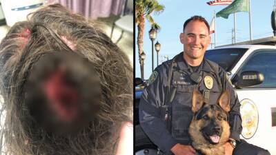 Brentwood police dog bit second woman in head, records reveal - fox29.com - Germany