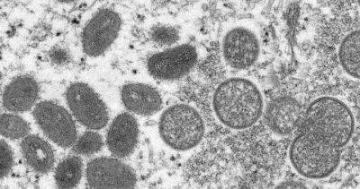 Don Vinh - U.S. confirms monkeypox case in man who recently travelled to Canada - globalnews.ca - Usa - Spain - Canada - state Massachusets - Portugal