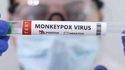 In a first, man tests positive for Covid, monkeypox and HIV. Check symptoms - livemint.com - India - Italy - Spain