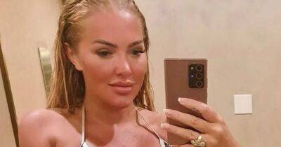 Curtis Pritchard - Big Brother's Aisleyne left bruised up by new career move amid gruesome health battle - dailystar.co.uk - Britain - Argentina