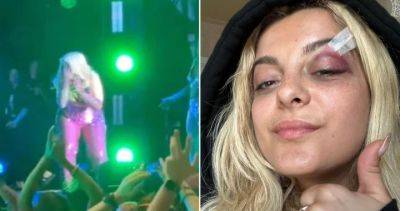 Bebe Rexha - Bebe Rexha collapses after fan throws phone at her face, man arrested - globalnews.ca - New York - city New York