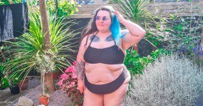 Woman, 24, bullied for ‘granny legs’ caused by health condition - manchestereveningnews.co.uk - Spain - Britain - city Manchester