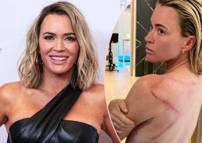 Michael Strahan - Teddi Mellencamp Shows Off Huge Scar After Melanoma Successfully Removed In Surgery! - perezhilton.com