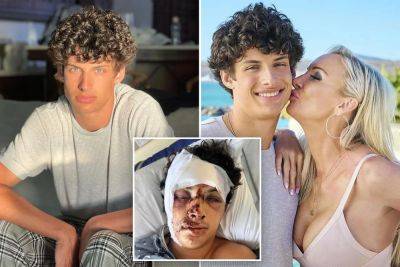 ‘MILF Manor’ star Joey Burford needs facial reconstruction surgery after horror scooter accident - nypost.com - state California - county Long