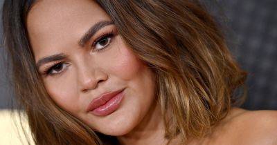 Chrissy Teigen - Paul Nassif - Chrissy Teigen shares 'crazy' results of eyebrow transplant – as hair is taken from back of head and stitched to face - ok.co.uk