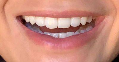 'Miracle' teeth whitening powder that 'reverses' stains after one treatment is on sale - ok.co.uk