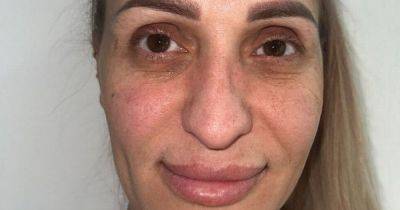 Woman heads to Turkey for surgery makeover – and is totally unrecognisable after - manchestereveningnews.co.uk - city Istanbul - Turkey