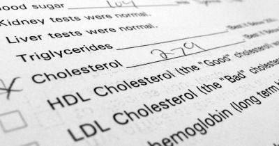 Doctor says stop eating these common food items to lower your cholesterol - dailyrecord.co.uk