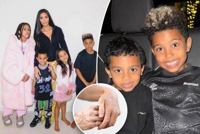 Kim Kardashian - Michael Jackson - Kanye West - Jon Hamm - Winnie Harlow - What is vitiligo? All about the disease affecting Kim Kardashian’s son - nypost.com