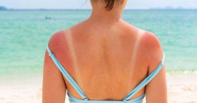 The best products to ease the pain of sunburn and which ones to avoid - dailyrecord.co.uk - Hawaiian