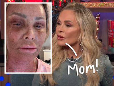 Tamra Judge Gets Roasted By HER OWN MOM Over Gruesome Plastic Surgery Recovery: 'Your Face Literally Makes Me Want To Throw Up' - perezhilton.com - state California - county Orange - county Newport - county Baker